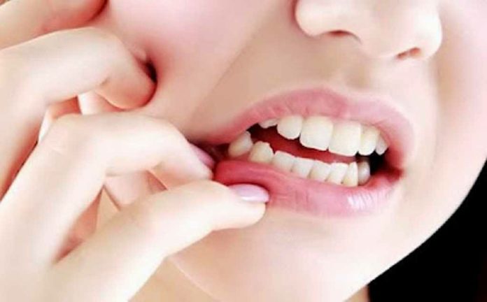 Gum Care rasa jahe herbal dan mint.