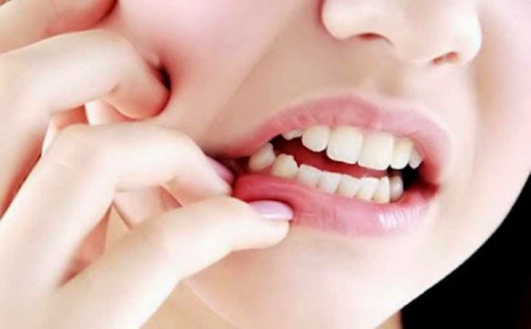 Gum Care rasa jahe herbal dan mint.