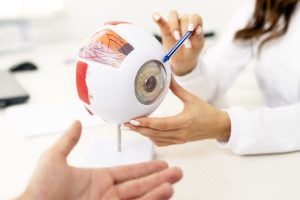 Operasi Lasik